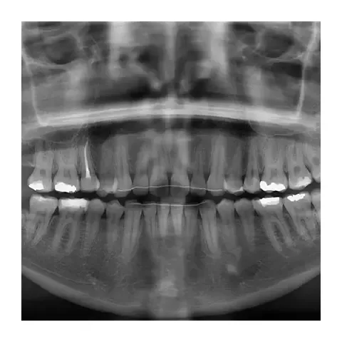 Endodoncija