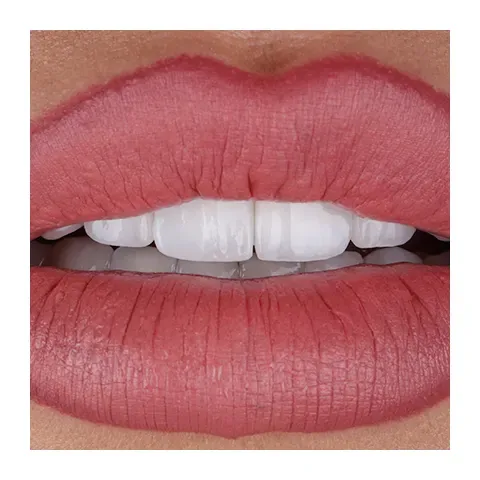 Estetska Stomatologija